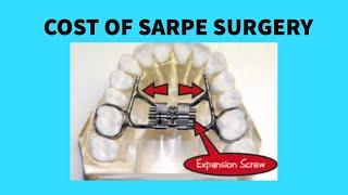 COST OF SARPE SURGERY!!!
