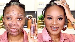 TRY THIS TRICK FOR ENLARGED PORES, ACNE & HYPERPIGMENTATION (MAKEUP TIPS) | OMABELLETV