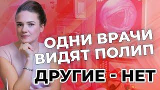 Одни врачи видят полип, другие -нет.