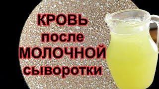 Кровь после молочной сыворотки