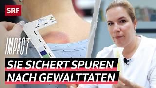 Häusliche und sexuelle Gewalt – Forensic Nurses sichern Spuren nach Gewalttat | Impact | SRF