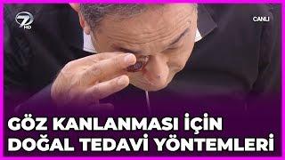 Dr.  Feridun Kunak Show | 3 Ocak 2019 | Göz Kanlanması İçin Doğal Tedavi Yöntemleri