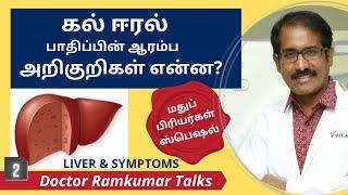 கல்லீரல் பாதிப்பின் ஆரம்ப அறிகுறிகள்? கல் ஈரல் கொழுப்பு? வீக்கம்? மஞ்சள் காமாலை? Liver & You.