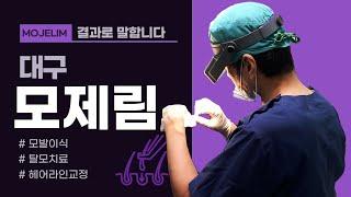 대구헤어라인 교정하는 모발이식의 전과 후! 한눈에 확인해 보시고 선택하세요[대구모제림모발이식]