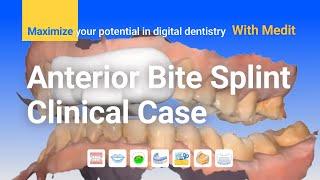 Clinical case - Anterior Bite Splint