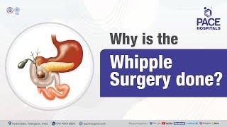 Why is the Whipple Surgery done? | PACE Hospitals #shortvideo #whippleprocedure #pancreaticcancer