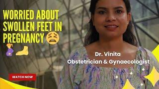 Swollen feet in pregnancy! Dr. Vinita @Obstetrician-Gynaecologist