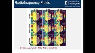 ISMRM MR Academy - Side Effects of High Magnetic Fields