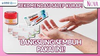 3 Rekomendasi Obat Kurap di Tubuh  Rekomendasi Salep Kurap!