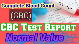 CBC Test ll CBC Blood Test ll Complete Blood Count ll CBC in Bengali ll @mlt_pathsala