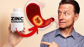 Fix Ulcers and Gastritis with Zinc Carnosine