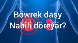 Böwrek daşy hakynda gyzykly maglumatlar