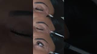 Dr. Fidan Mustafayeva və Razi Əliyeva -Saç mezoterapiyası/botox/Masseter botox