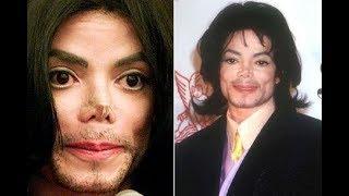 Horrifying state of Michael Jackson's 'real' nose - 'exposed cartilage and no nostrils'