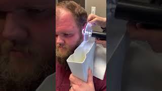 Extracted Baby EARWAX Stuck In Ear Canal | 耳掃除/耳垢の除去 耳垢そうじ 難聴を伴う巨大な右耳垢