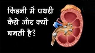 किडनी में पथरी कैसे बनती है? | Kidney Stone | Animated Video |