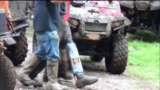 BROKEN LEG ATV RIDE!!! OUCH!!!!