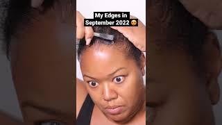 Watch my edges transform from thin and sparse to full and healthy  #naturalhairgrowth #edgegrowth