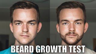 CPH Grooming vs Minoxidil - I tried both (Beard Growth)