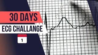 Day 1: Know Your Expertise in ECG Interpretation | 30-Day ECG challenge