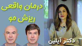 درمان سریع ریزش مو مردان و زنان با دکتر آیلین  _ dr aylin