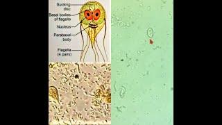 Giardia lamblia & Trichomonas Vaginalis | Microbiology exam spotters