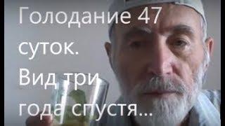 Голодание 47 суток, вид, спустя три года