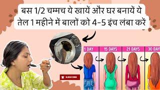 1 महीने में बालों को 4-5 इंच लंबा करें | सफेद बालों को जड़ से काला करें | Upasana Hairfall Remedy