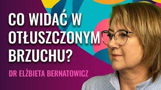 Ukryte Zagrożenia i Ryzyko Otłuszczonego Brzucha - Dr Elżbieta Bernatowicz