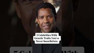 5 celebrities with genetic traits you’ve never seen before#celebrity#hollywood#fyp#celebrities#usa