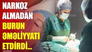 NARKOZ ALMADAN ESTETİK BURUN ƏMƏLİYYATI