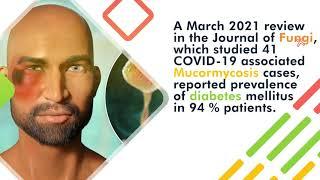 Controlling Blood Sugar Level: Instrumental in Preventing Mucormycosis or Black Fungus Post COVID