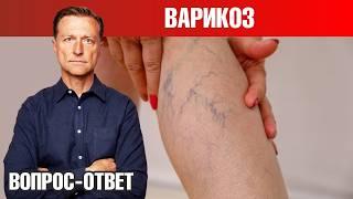 Как избавиться от варикоза  лучший способ и профилактика