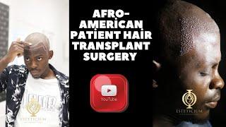 Afro-American patient Hair Transplant surgery  - Esteticium Hair Transplant Turkey