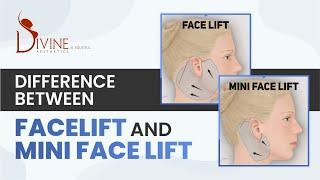 Difference Between Facelift & Mini Facelift by Dr. Amit Gupta | Divine Cosmetic Surgery - April 2021