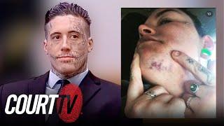 'He Bit My Face': Wade Wilson's Ex-Girlfriend Describes Alarming Attack