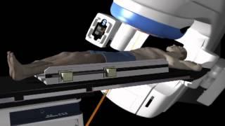 A First from SWFL: Stereotactic Body Radiation Therapy for Gynecological Cancers