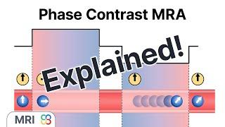 What is Phase-Contrast Magnetic Resonance Angiography (MRA)? - MRI explained