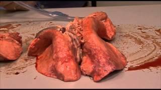 Lung inflation in HD video