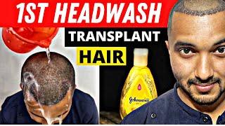 Doing First Head Wash After Hair Transplant With Prabhat Nawani