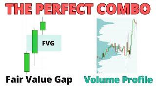 Fair Value Gap + Volume Profile: The Perfect Combo for Smart Money Trading