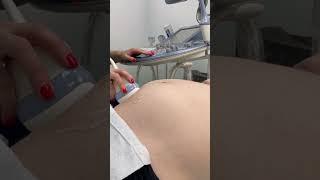 УЗИ ПЛОДА В КЛИНИКЕ "ПЕРВОЕ СЛОВО" 
