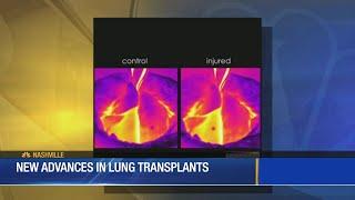 Major lung disease breakthrough at Vanderbilt