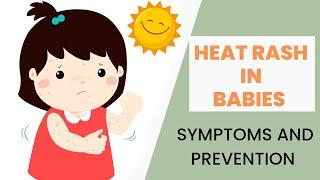 Heat Rash in Babies/ What is Heat Rash/ Symptoms and Prevention of Heat Rash