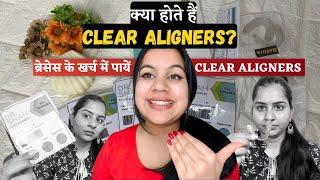 क्या होते हैं Clear Aligners? | कितना समय और खर्च लगता है? | Invisible Braces at Affordable Price