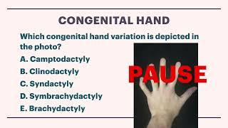 Hand Surgery Question of the Week 33