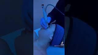 Hydrafacial Step by Step