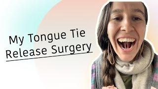 Tongue Tie Release Surgery w/ Laser - Posterior Adult Tongue Tie - How I'm Doing Post-Release