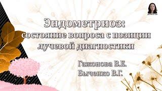 Эндометриоз - состояние вопроса с позиции лучевой диагностики.  Гажонова В.Е., Быченко В.Г.