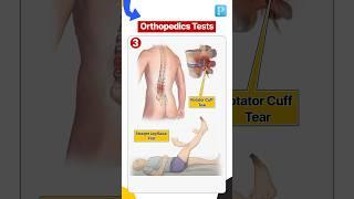 Must Know Orthopedics Test!